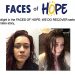 FACES OF HOPE: WE RECOVER  …Misty Borders’ story