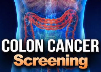 FRANKFORT DOCTOR SAYS COLORECTAL CANCER IS BECOMING MORE COMMON IN YOUNGER AGE GROUP