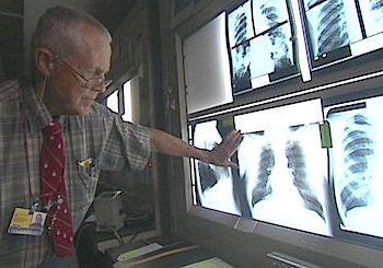 100 COAL MINERS, MINERS’ WIDOWS, EXPERTS MEET ABOUT BLACK LUNG EPIDEMIC, URGE CONGRESS TO ACT