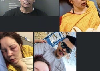 LAWRENCE COUNTY MAN IN CUSTODY AFTER TORTUOUS BEATINGS OF GIRLFRIEND