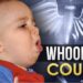Pertussis, Whooping Cough Cases Increasing Across Kentucky